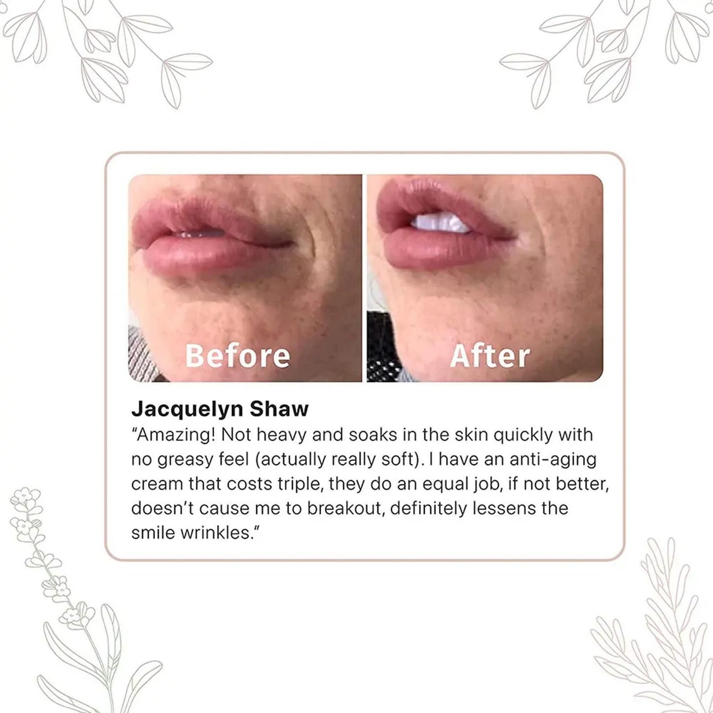 Retinol Cream 100gm Pack of 2